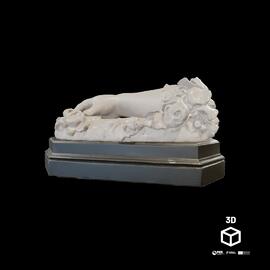 Mão e antebraço direitos de criança