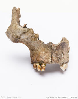 Restos osteológicos humanos