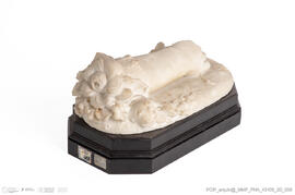 Mão e antebraço direitos de criança