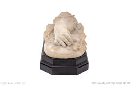 Mão e antebraço direitos de criança